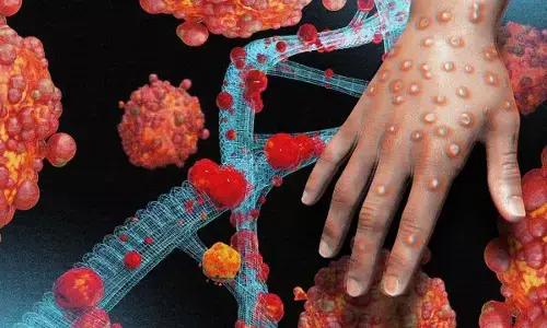 Wake up to prevent another global pandemic