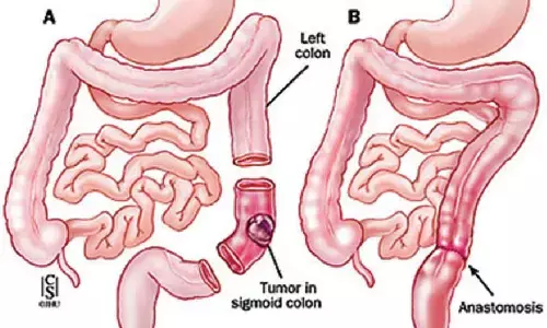 Nonagenarian achieves smooth recovery post-surgery