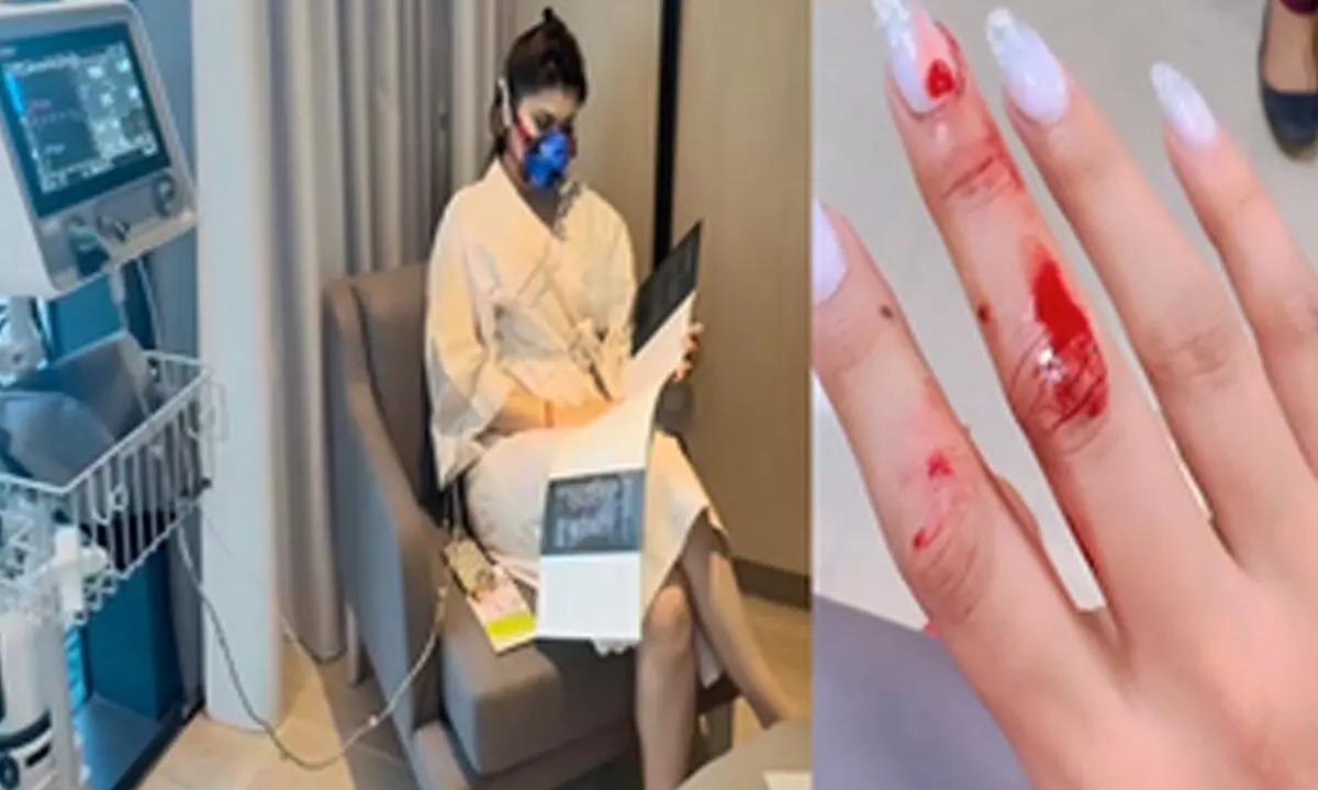 Urvashi Rautela trolled for getting admitted in hospital for a minor cut