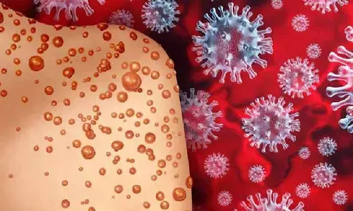 3 govt hospitals to set up rooms for Mpox cases