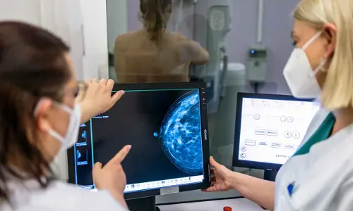 Women less likely to screen for breast cancer over false-positive mammograms