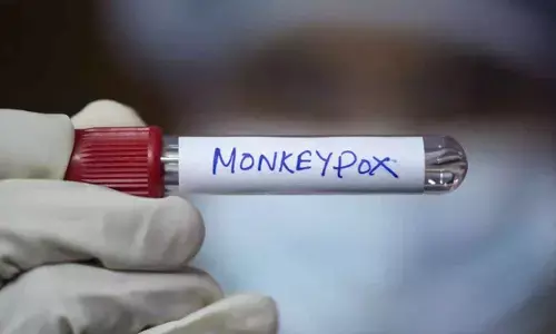 Bengaluru Man Tests Positive for Mpox Virus After Dubai Trip: Report