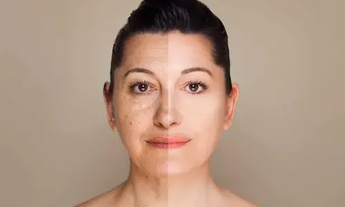 Representational image