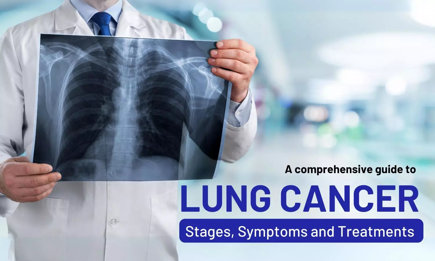 A Quick View of Lung Cancer Causes, Symptoms, Treatments, and Preventions