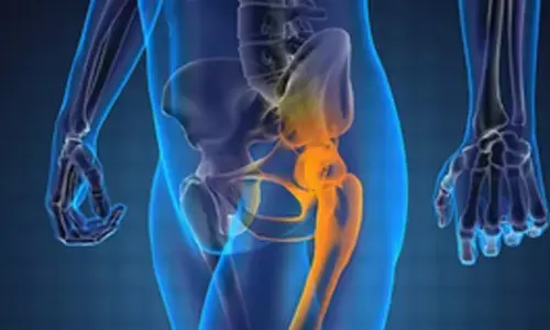 Prostate cancer: A curable ailment that causes social stigma