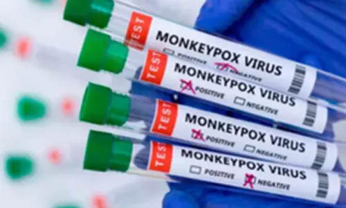 WHO donates 5,000 mpox sample collection kits to Uganda