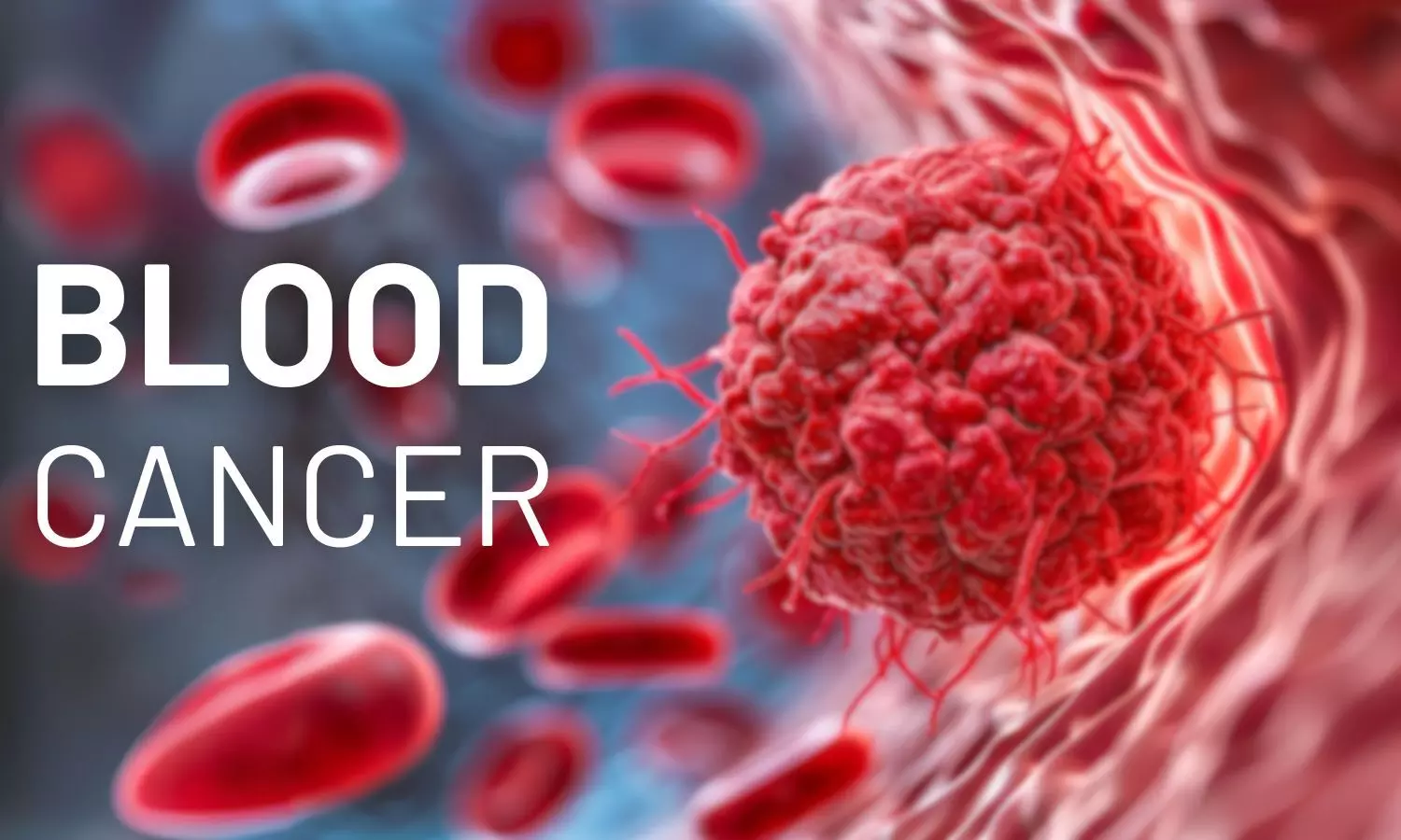 Blood Cancer- Impact, Diagnosis, and Importance of Early Detection