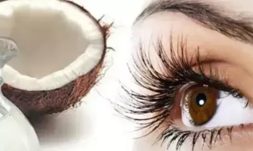 Want naturally long eyelashes? Try these simple remedies