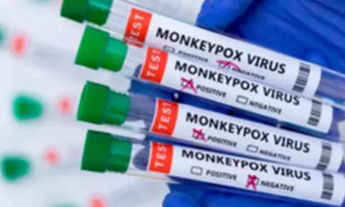 Africa CDC donates equipment to boost mpox immunisation in South Sudan