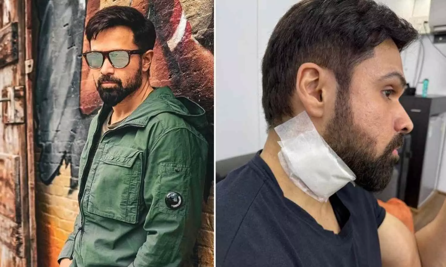 Emraan Hashmi Injured While Filming ‘Goodachari 2’ in Hyderabad