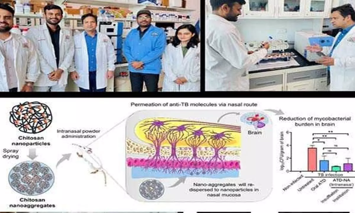 New method to reduce TB bacteria in brain developed