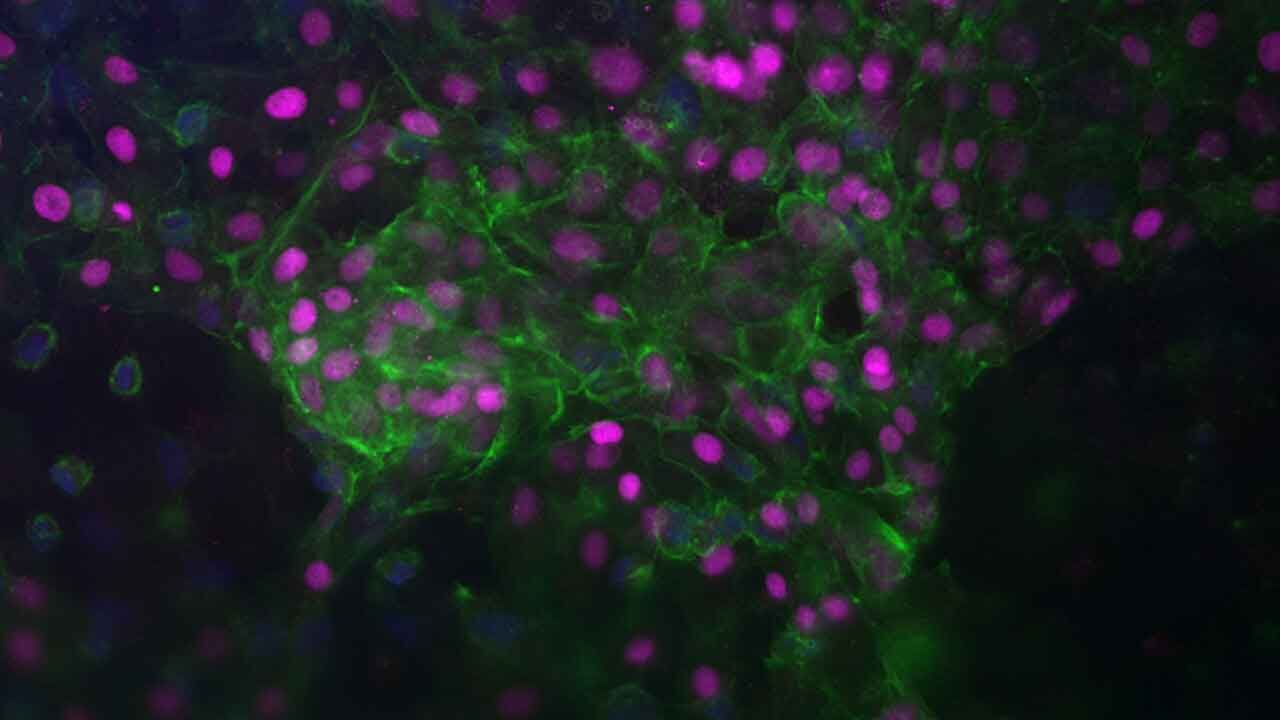 Liver tissue from space may transform traditional transplants