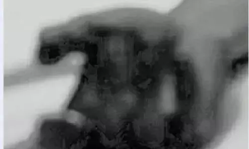 Woman slits wrist, sends video to boyfriend; he faints and dies