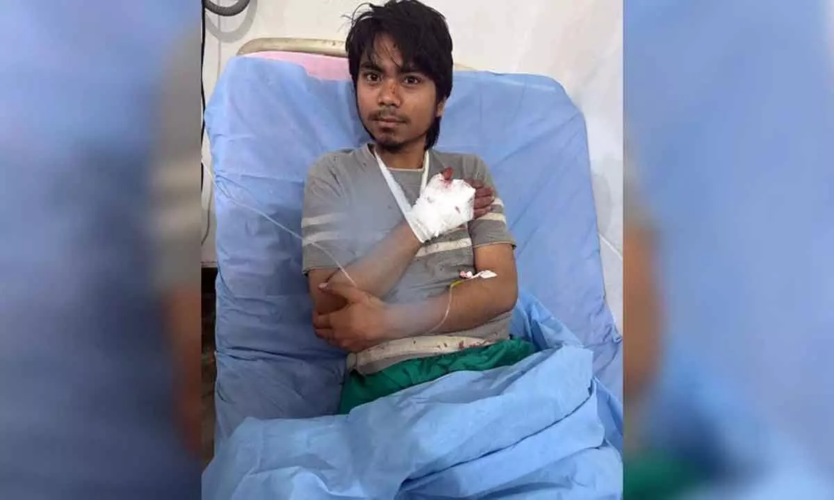 Teenager From Uttar Pradesh Injured, Third Attack On Migrant Workers In A Week In Kashmir