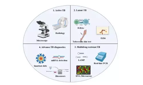 Goa leading in early TB detection