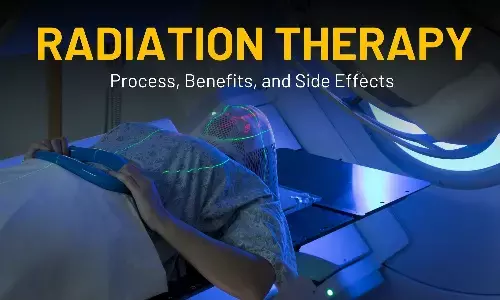 Radiation Therapy: What You need to know