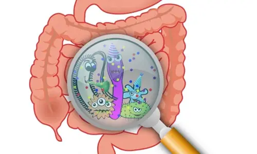 Gut microbiome changes may signal onset of rheumatoid arthritis