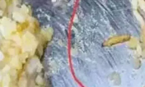 100 students fall sick after consuming contaminated food