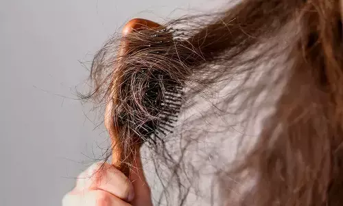 Effective Natural Ways to Combat Frizzy Hair in Winter