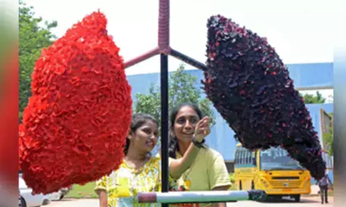 Women more likely than men to live for 5 years after lung transplant: Study