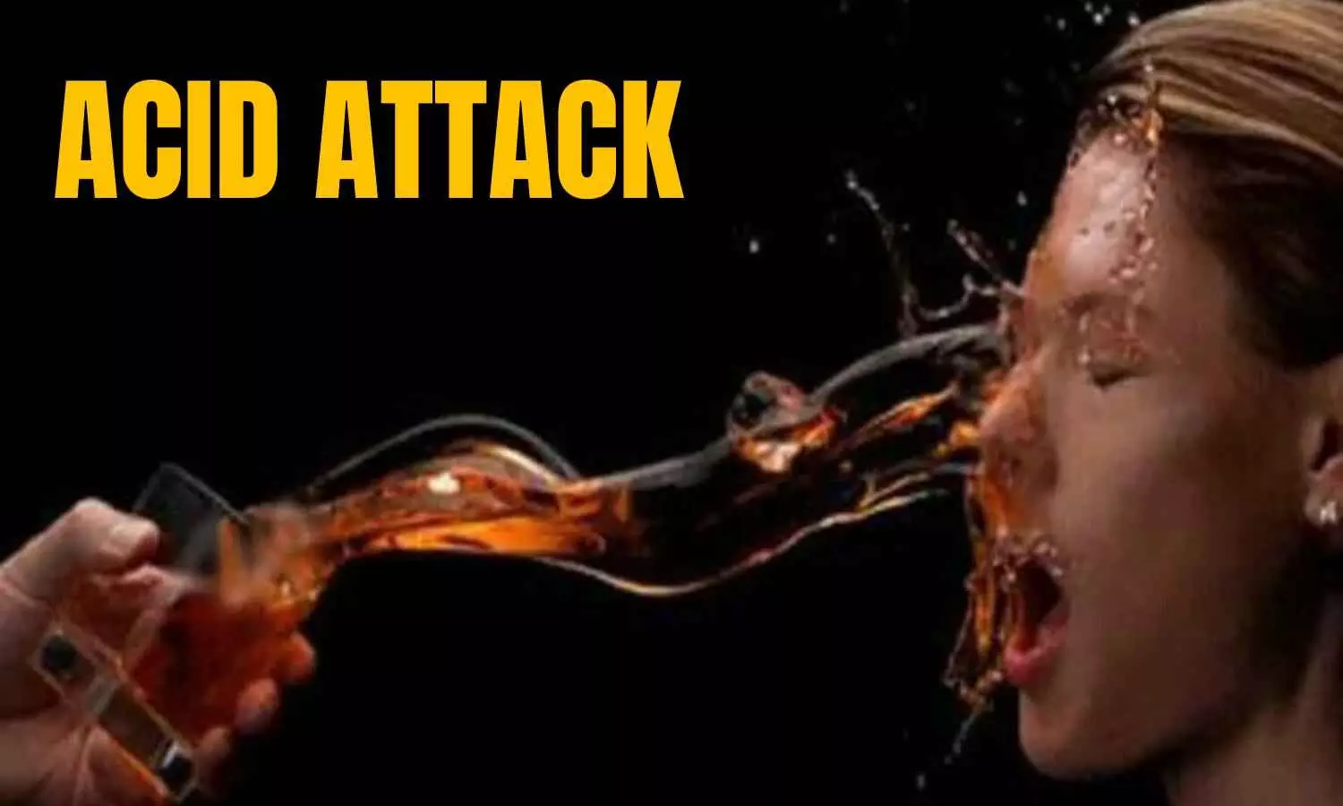 Telangana: Acid Attack on Nursing Student in Khammam After Stalking, Harassment Telangana: Acid Attack on Nursing Student in Khammam After Stalking, Harassment