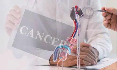 Essential Cancer Screenings: What You Need to Know for Early Detection