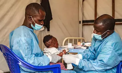 Mpox deaths in Africa exceed 100 since beginning of 2025