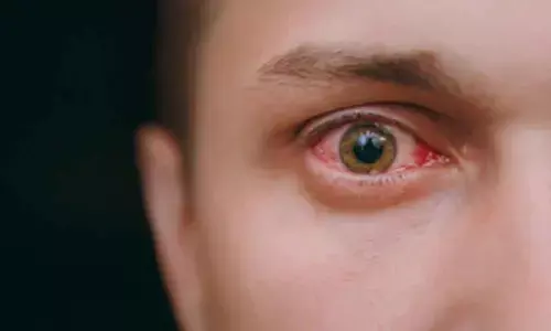 Human breast milk may heal corneal wounds: Study