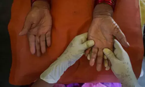 TN govt launches door-to-door leprosy detection campaign