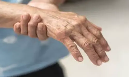 Guillain Barre Syndrome: 5 patients admitted to GGH