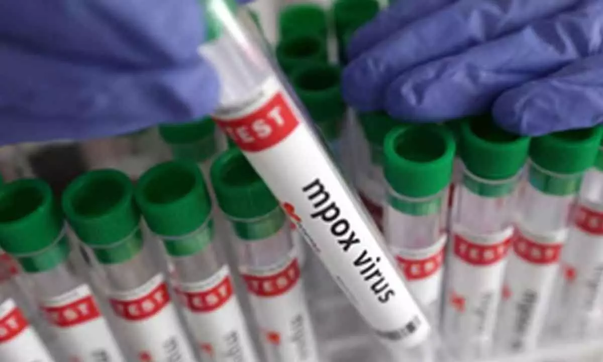 Kenyas monkey pox cases rise to 41 Kenyas monkey pox cases rise to 41
