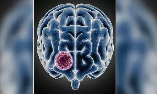 Landmark surgery conducted for giant meningioma on a patient from Ghana