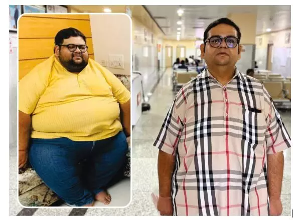 Bariatric Surgery Transforms Advocate’s Life at NObesity Bariatric Surgery Transforms Advocate’s Life at NObesity