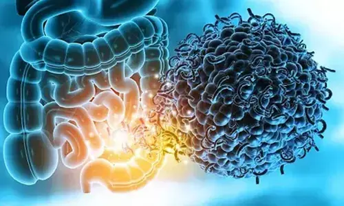 Study shows how gut microbiome raises risk of multiple sclerosis