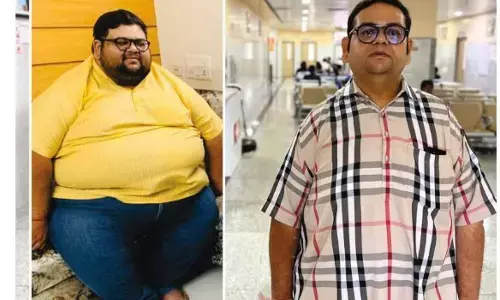 Bariatric Surgery Transforms Advocate’s Life at NObesity