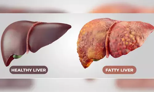 Over 80% of Indian IT workforce suffers from Fatty Liver Disease: UoH study