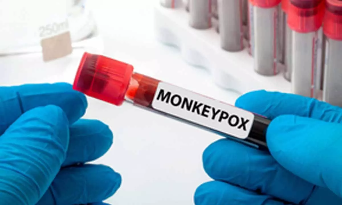 South Africa reports three new cases of monkeypox South Africa reports three new cases of monkeypox