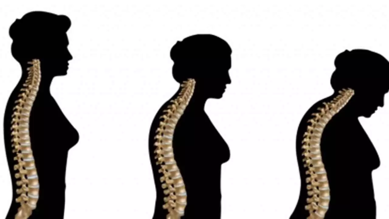 Celltrions bone disease biosimilars get approval in US Celltrions bone disease biosimilars get approval in US