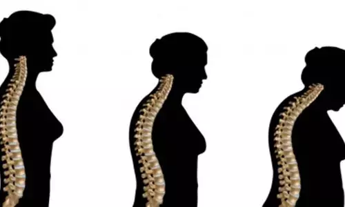 Celltrions bone disease biosimilars get approval in US