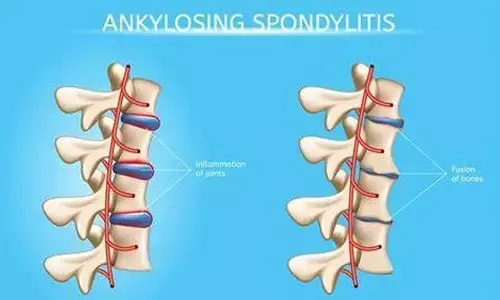 Endogamy causing hereditary diseases, says CCMB study
