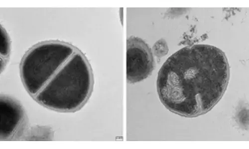 Human bodys protein recycling system fights bacteria like antibiotics: Study