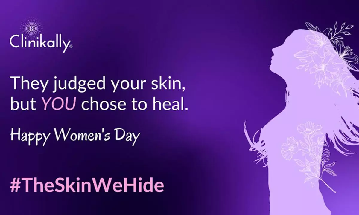 Clinikally launches ‘The Skin We Hide’ campaign, exposes the real struggles of women behind flawless skin standards Clinikally launches ‘The Skin We Hide’ campaign, exposes the real struggles of women behind flawless skin standards