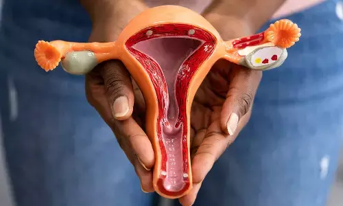 US researchers identify high-risk cells that may trigger ovarian cancer