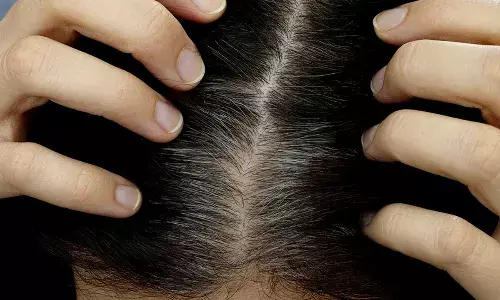 Natural Ways to Cover Grey Hair Without Dye