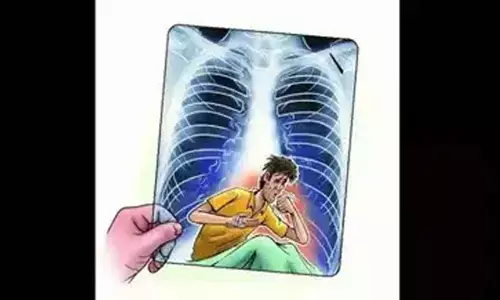 Eliminating TB: TG bags nat’l award for 100-day NAAT campaign
