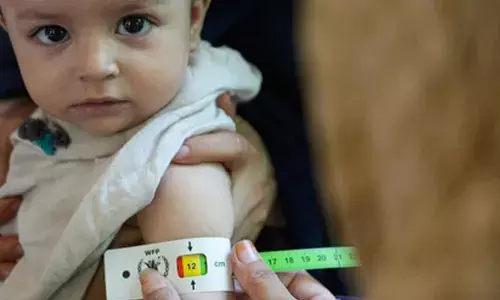 WFP warns of malnutrition threats in Afghanistan, 3.5 million children at risk in 2025