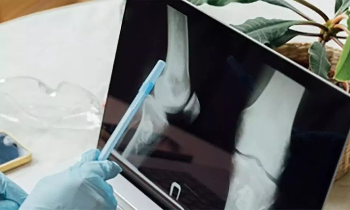 NIT Rourkela’s natural bioink to help 3D bioprinting of bone tissue NIT Rourkela’s natural bioink to help 3D bioprinting of bone tissue