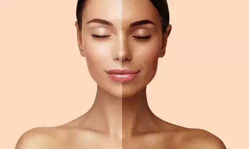 Effective Home Remedies to Remove Dark Tan from Your Face