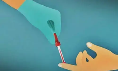 New blood test offers hope for early detection of Parkinsons disease