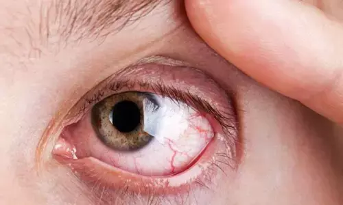 Diabetic Retinopathy – The increasing need for early detection and awareness